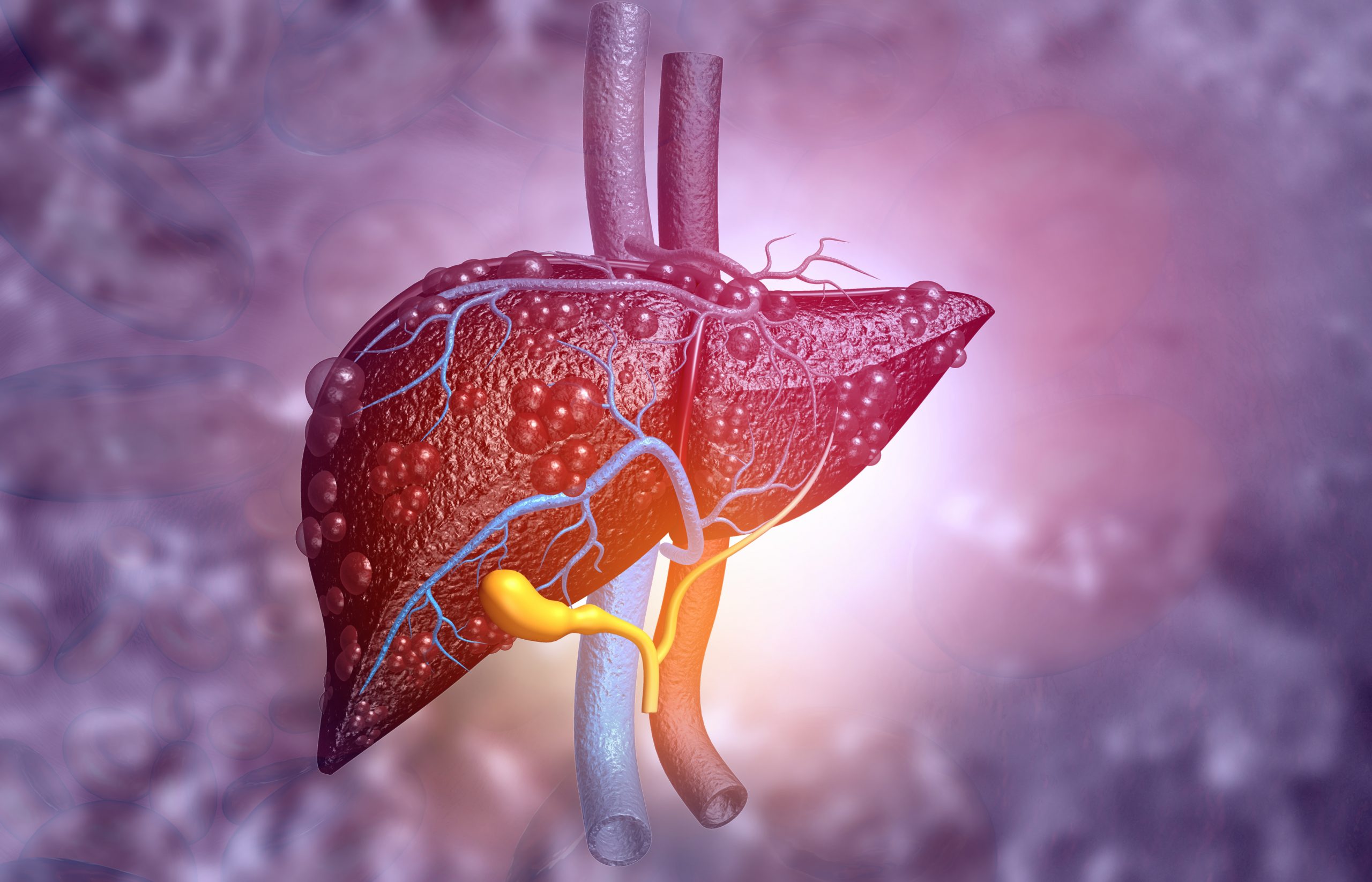 Pediatric Hepatology